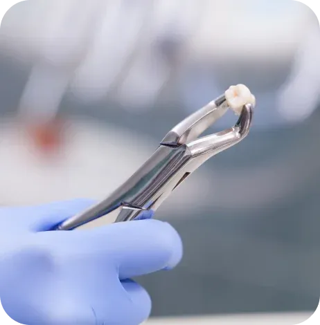 Affordable tooth extraction in Noblesville, IN