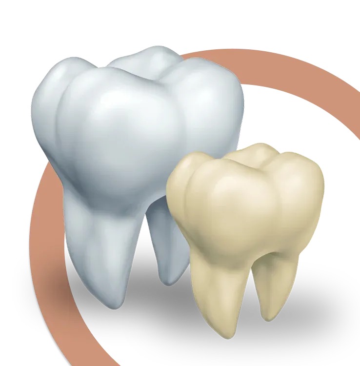 Brighten Your Smile with Teeth Whitening in Noblesville, IN