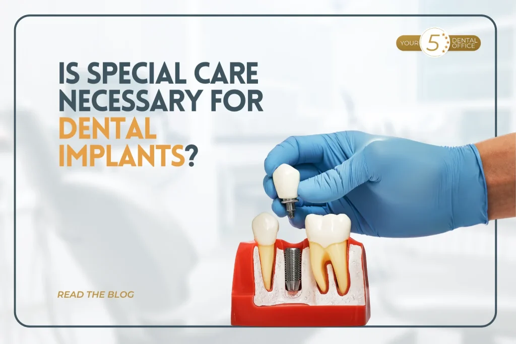 Dental implant care illustration with hand holding a prosthetic tooth and model of jawbone.