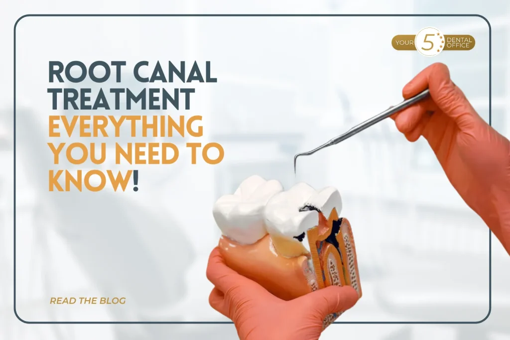 Root canal treatment illustration with dental tools and tooth model.
