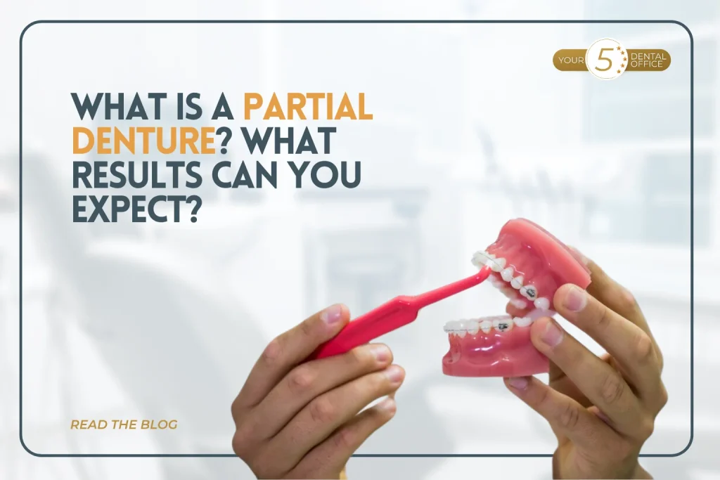 Partial denture being held with a toothbrush, illustrating dental restoration options at Skyview Dental in