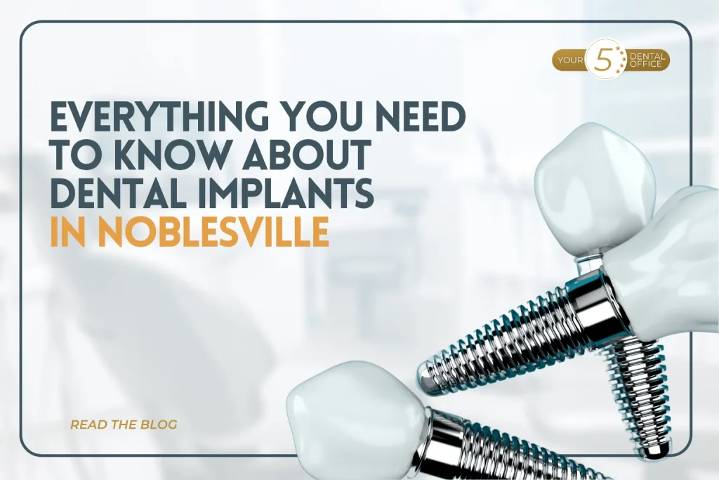 Dental implants and abutments illustrating restorative dental solutions in Noblesville.