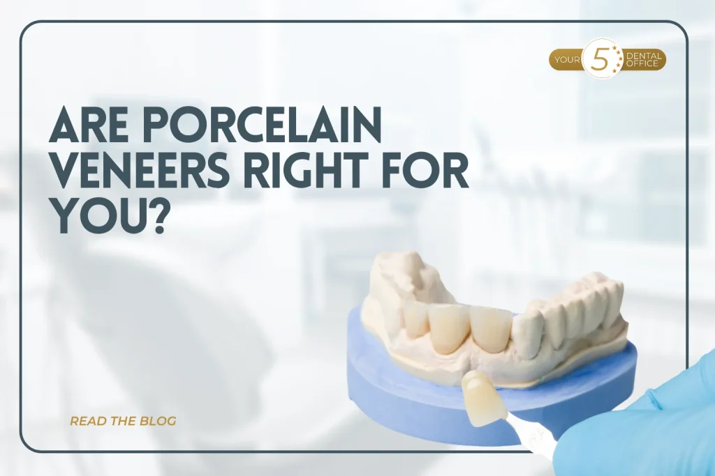 Porcelain veneers dental model illustrating cosmetic dentistry solutions at Skyview Dental in Noblesville.