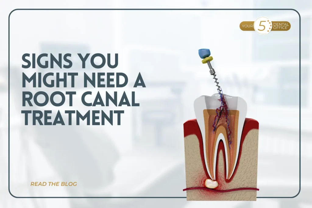 Root canal treatment illustration showing tooth and root with dental instrument, signs you might need