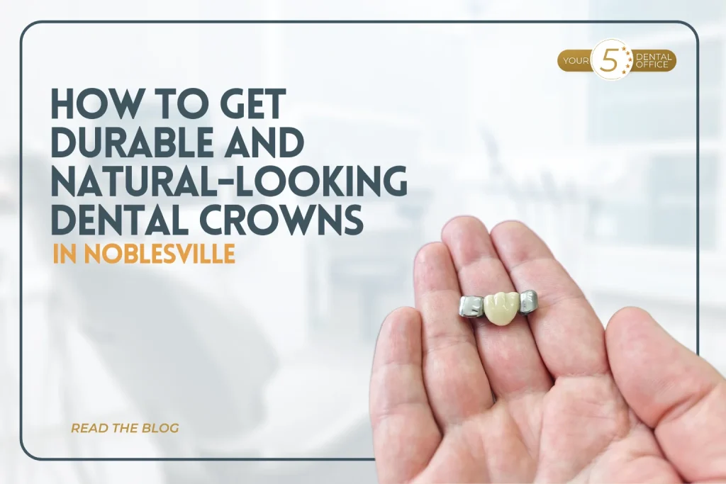 Dental crown restoration in a hand, illustrating durable and natural-looking dental crowns in Noblesville.
