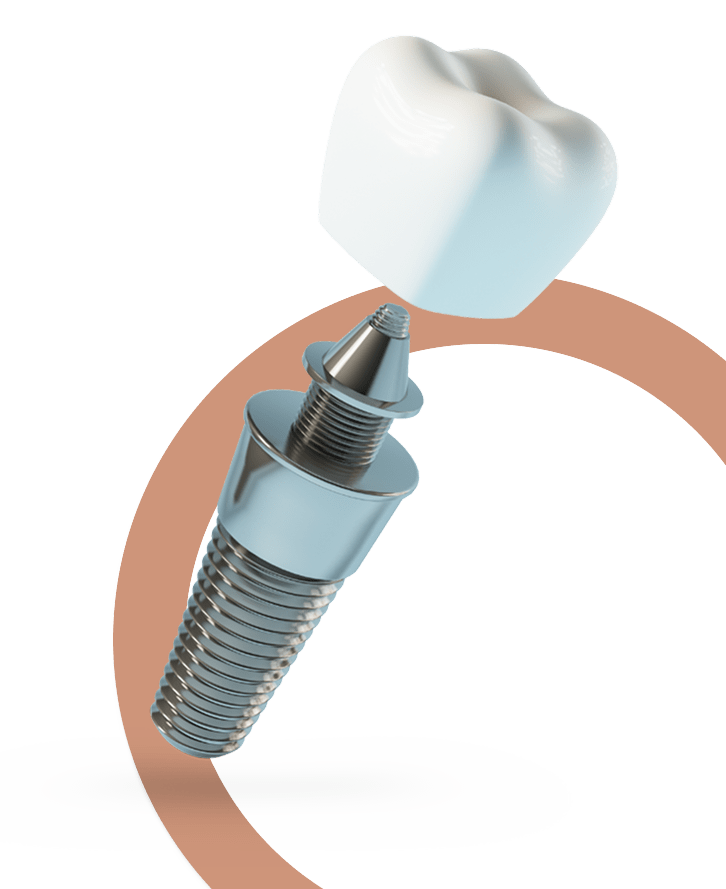Dental crowns