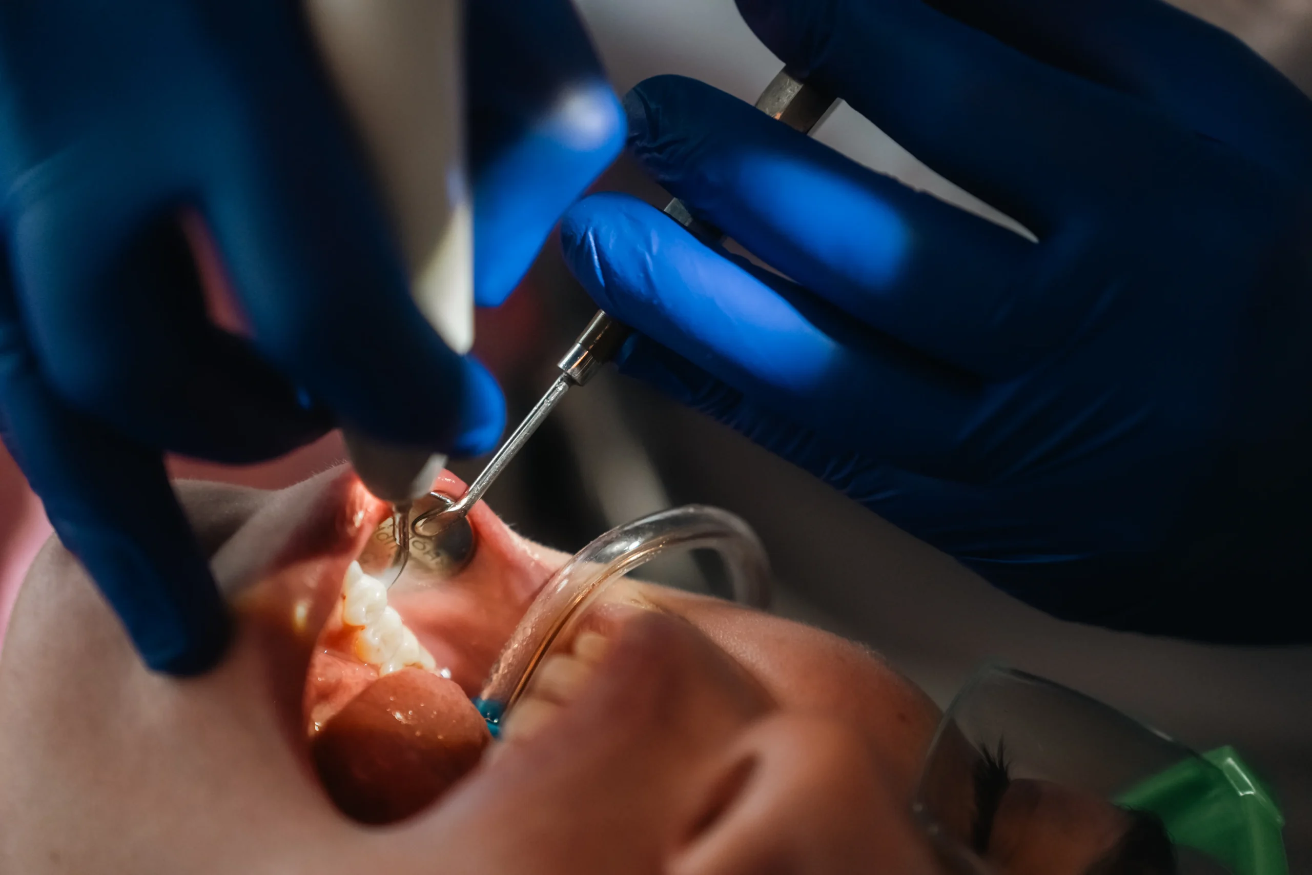 Dental treatment at Skyview Dental