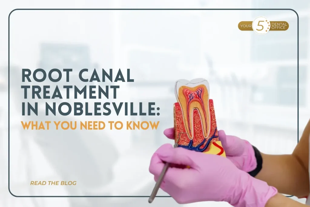 Root canal treatment illustration in Noblesville, IN, with dental professional's gloved hand.
