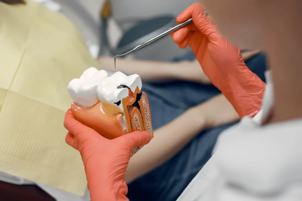 Emergency root canal treatment