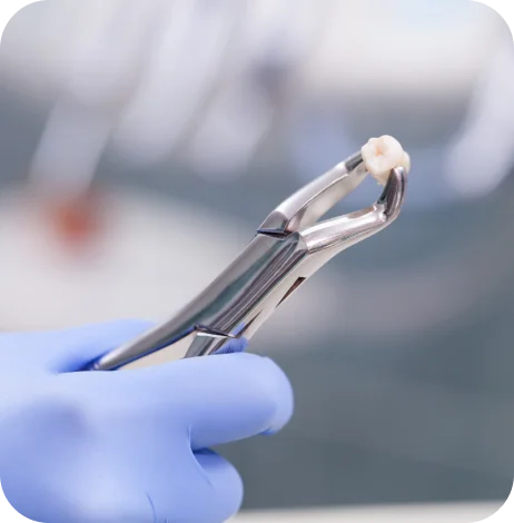 Affordable tooth extraction in Noblesville, IN