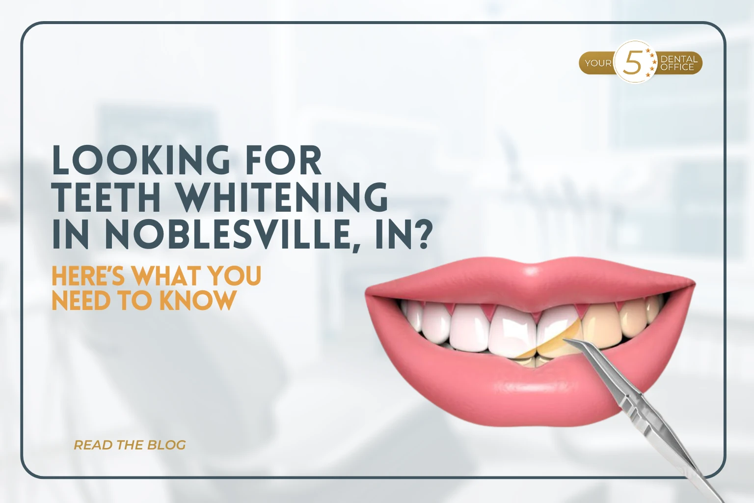 Teeth whitening in Noblesville: what you need to know
