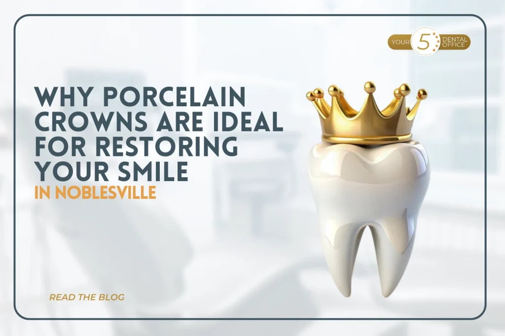 Golden porcelain crown on a tooth, illustrating smile restoration in Noblesville.